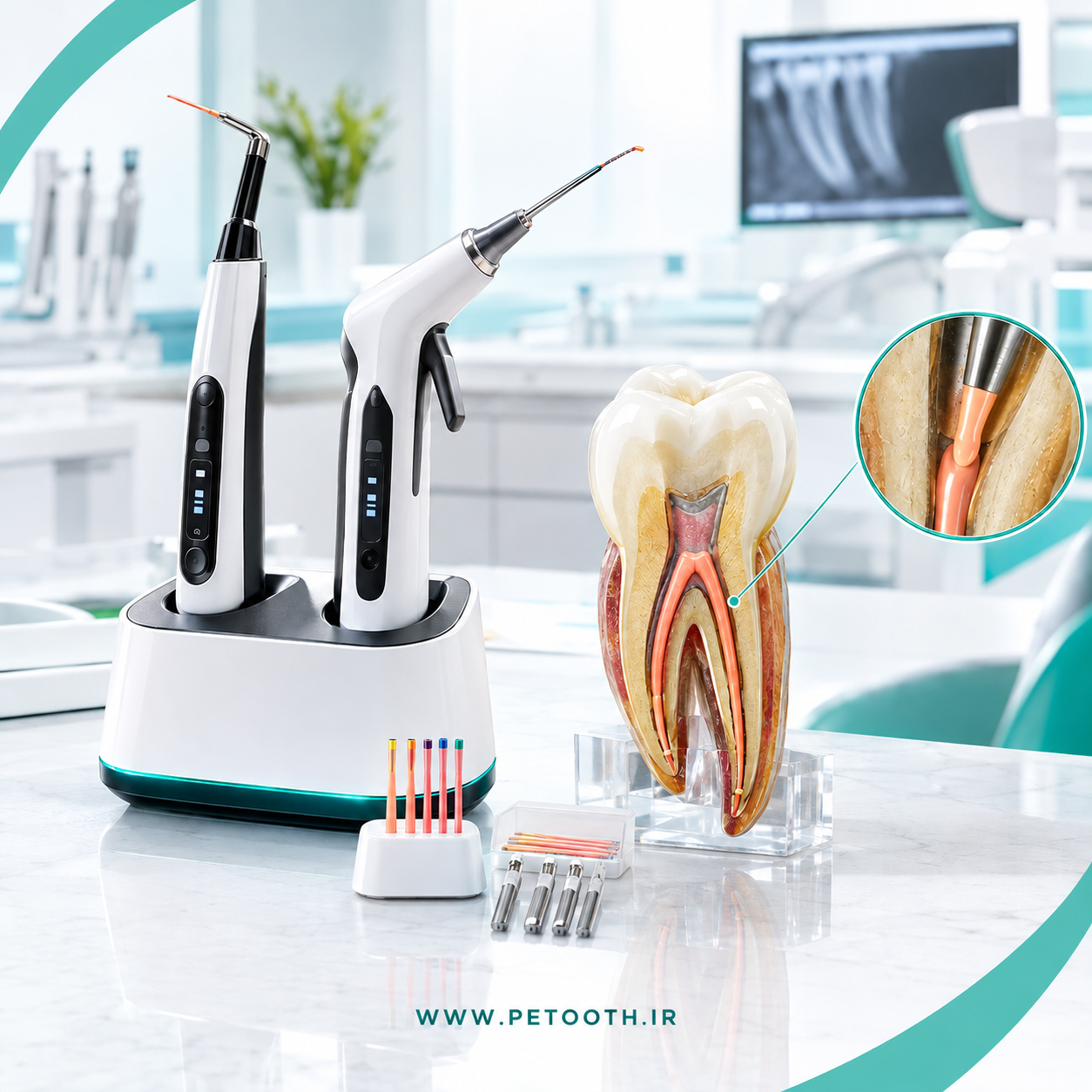 آبچوراتور چیست؟ همه چیز درباره آبچوراتور دندانپزشکی