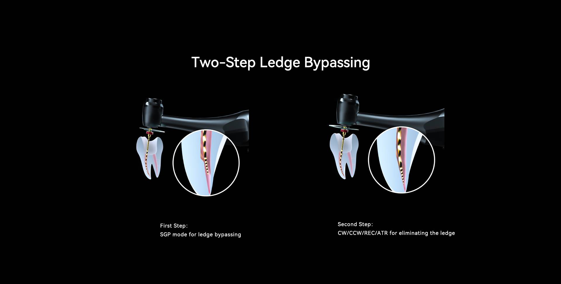 عبور از لِجبا اپکس روتاری 812 MT (Ledge Bypassing) در دو مرحله