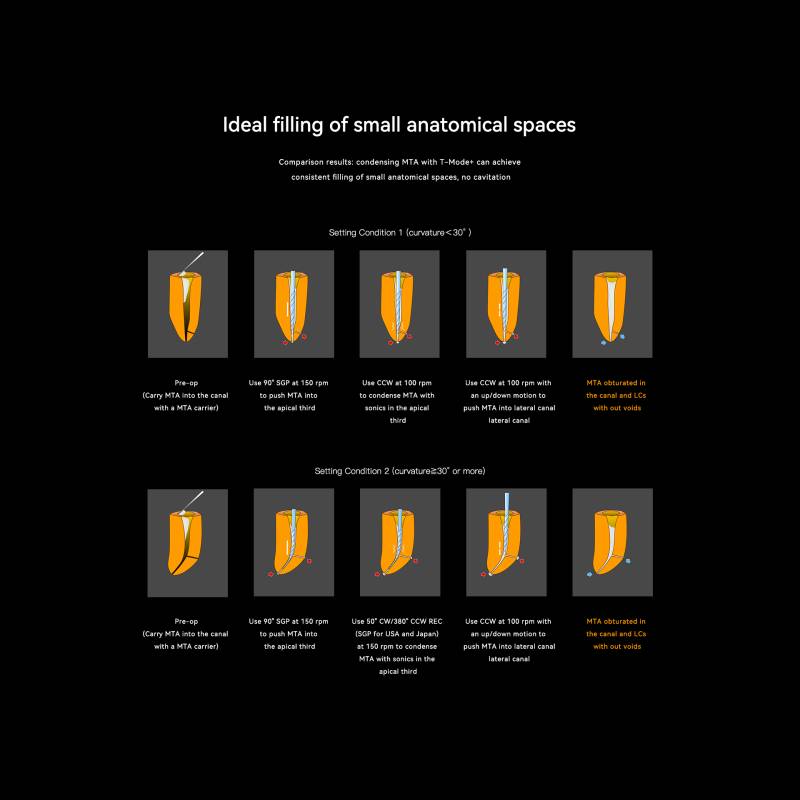 مزایای دستگاه اپکس روتاری Woodpecker 812 MT