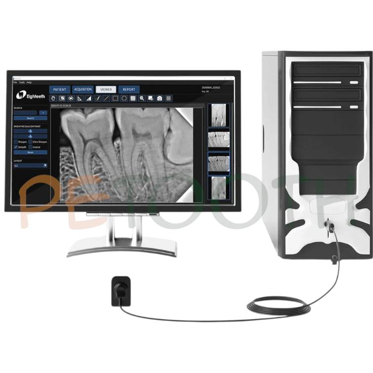 سنسور RVG ایتیس