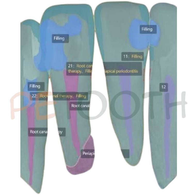 سنسور RVG وودپکر مدل I SENSOR