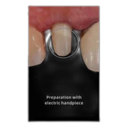 هندپیس الکتریکی