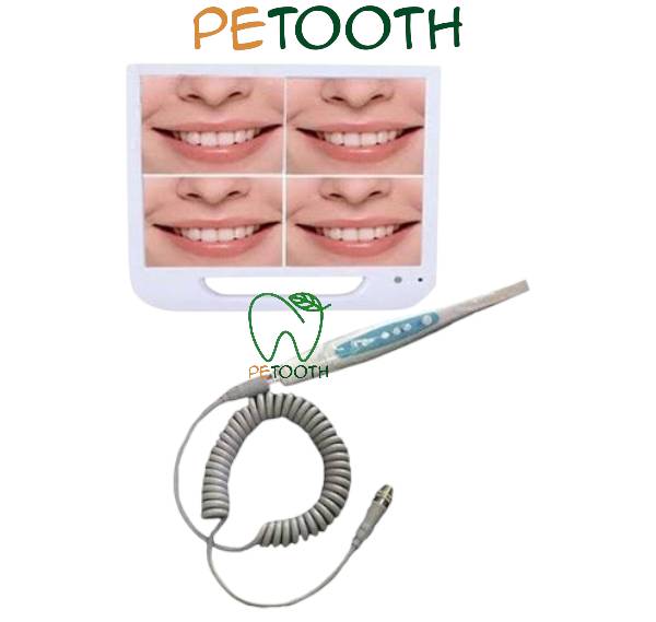 مانیتور و دوربین داخل دهانی FTZ