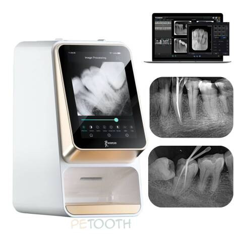 اسکنر فسفرپلیت وودپکر Woodpecker مدل آی اسکن i-Scan | پتوس