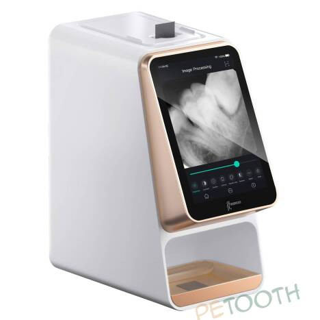 اسکنر فسفرپلیت وودپکر Woodpecker مدل آی اسکن i-Scan | پتوس