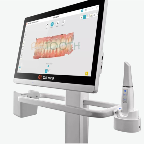 اسکنر داخل دهانی دکسس DEXIS | پتوس