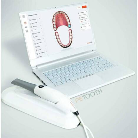 اسکنر داخل دهانی تری دیسک 3Disc مدل هیرون Heron IOS | پتوس