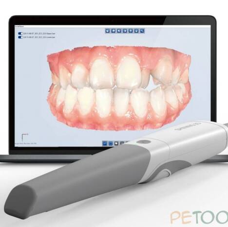 اسکنر داخل دهانی شاینینگ shining 3D | پتوس