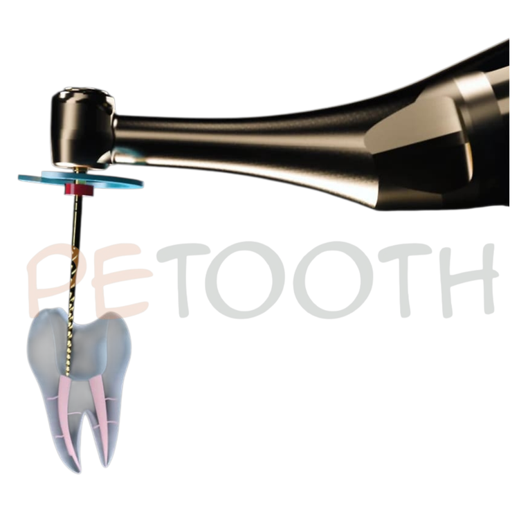 اپکس روتاری وودپیکر مدل Ai Motor | پتوس