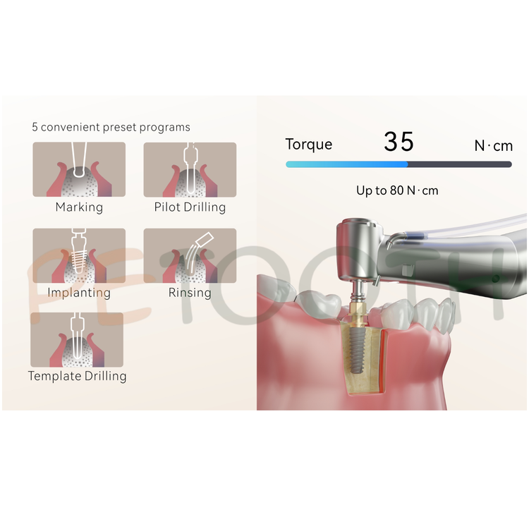 موتور ایمپلنت و موتور الکتریکی جراحی و پیزوسرجری سه کاره وودپکر Surgic Star woodpecker | پتوس