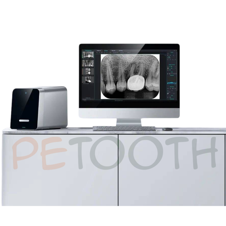 اسکنر فسفرپلیت وودپکر مدل Free Scan | پتوس