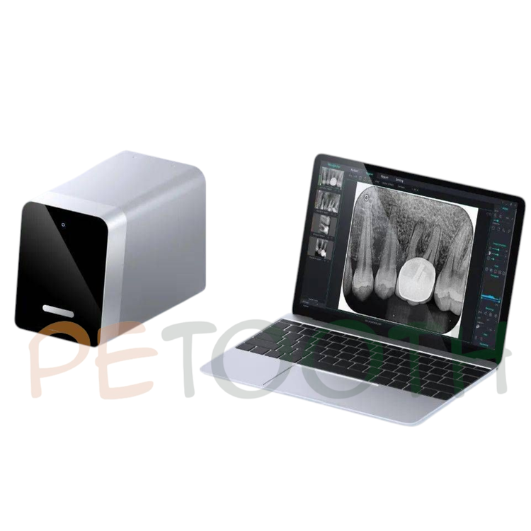 اسکنر فسفرپلیت وودپکر مدل Free Scan | پتوس