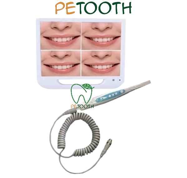 دوربین داخل دهانی و مانیتور FTZ | پتوس دنتال