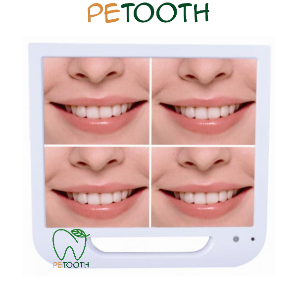 دوربین داخل دهانی و مانیتور FTZ | پتوس دنتال