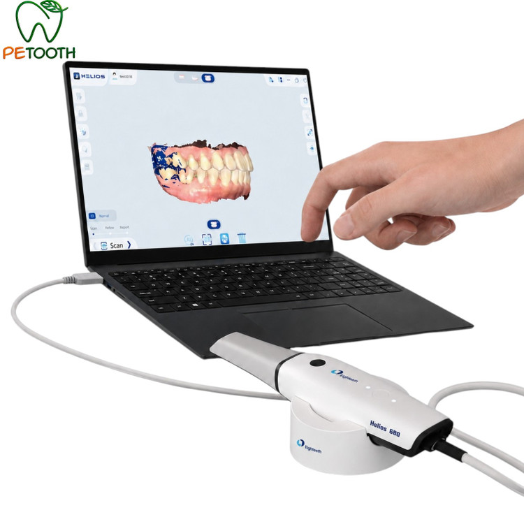 اسکنر داخل دهانی ایتیس HELIOS 680