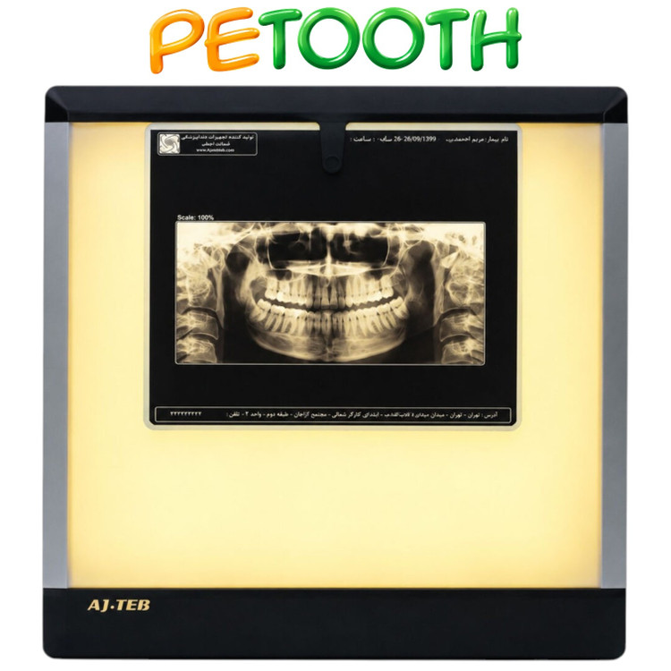 نگاتسکوپ دیجیتال عاج طب مدل CTX-PG-Dual
