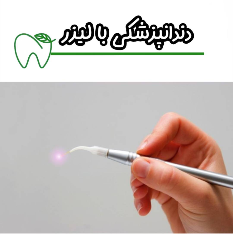 دندانپزشکی با لیزر