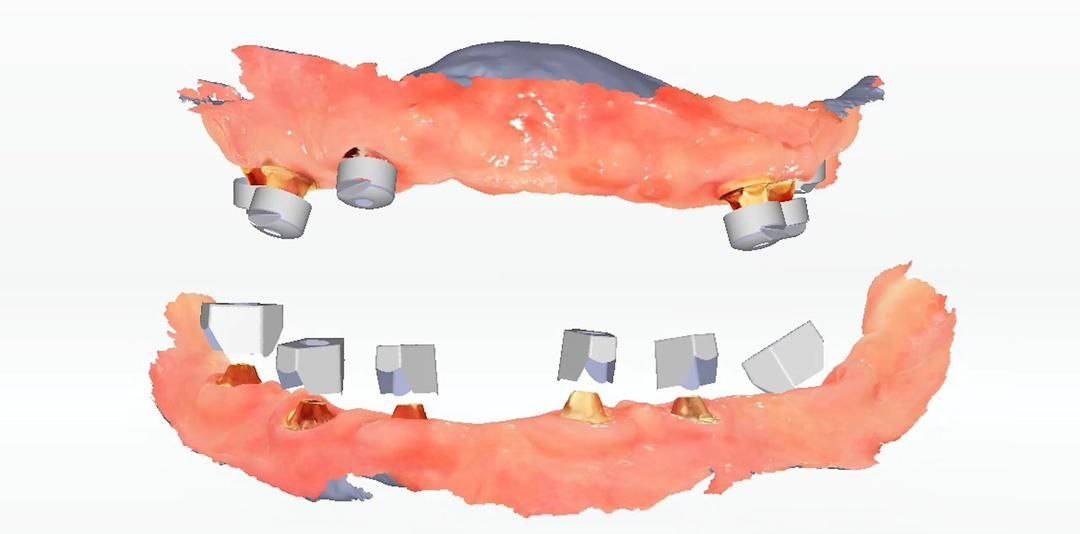 aoralscan elite