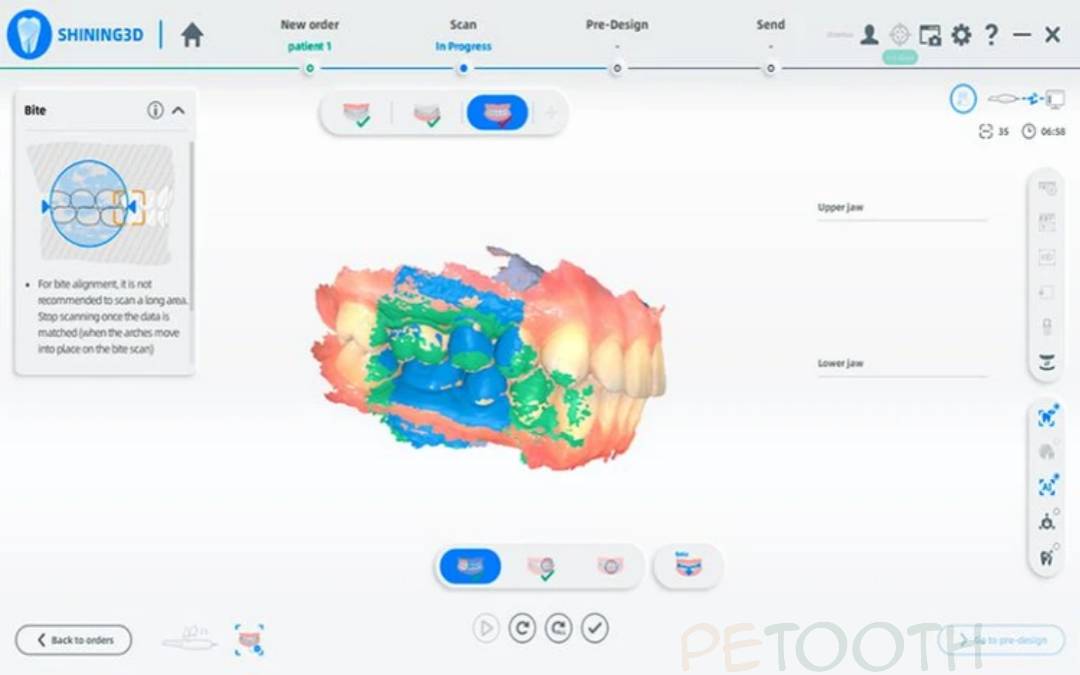 Aoralscan shining 3D